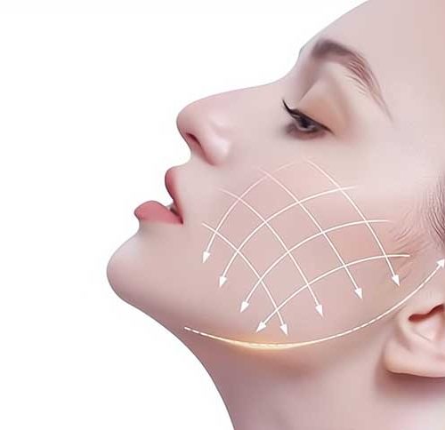 Discover the Secret to Flawless Facial Contouring with Ultherapy Skin Tightening: Achieve Radiant